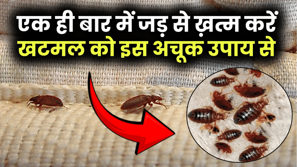 खटमल से परेशान? एक ही बार में जड़ से ख़त्म करे खटमल को इस अचूक उपाय से