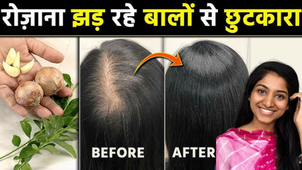 1 महीने में बालों में दिखेगा जबरदस्त फर्क! अपनाएं ये 6 देसी नुस्खे – बाल होंगे लंबे, घने और मजबूत