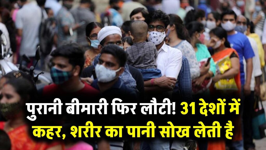 31 देशों में फिर लौट आई सालों पुरानी रहस्यमयी बीमारी, शरीर का पानी सोख लेती है