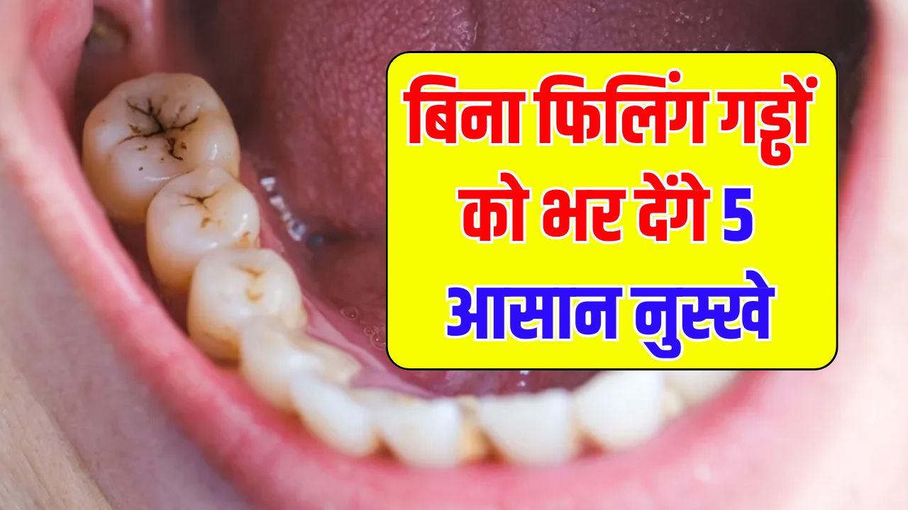 मीठा खाने से दांत खराब? बिना फिलिंग गड्ढों को भर देंगे 5 आसान नुस्खे