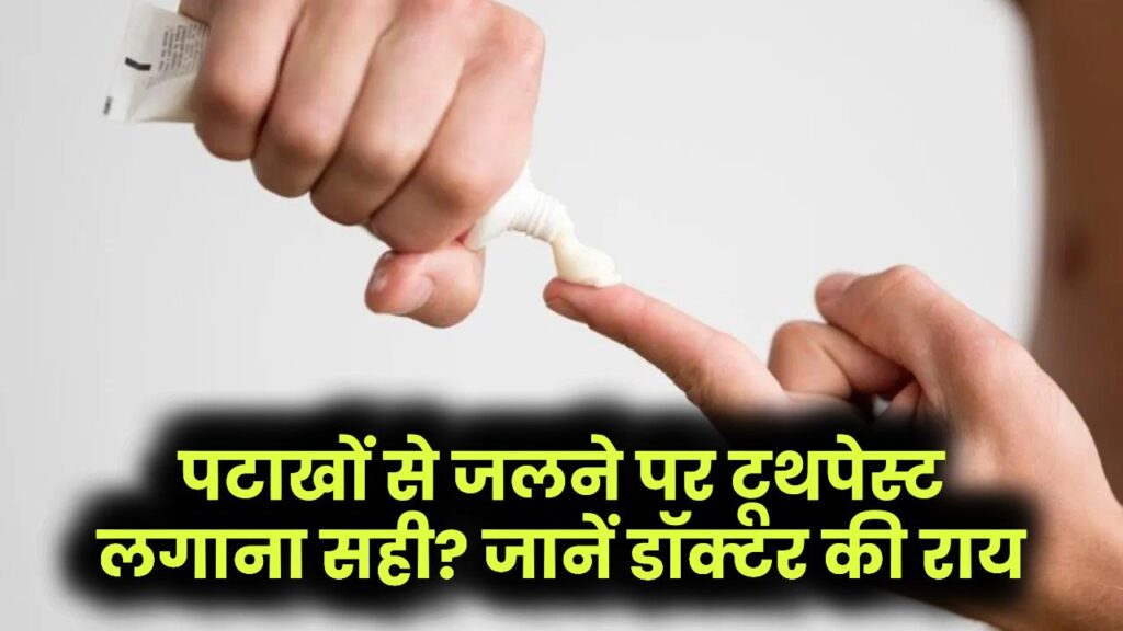 पटाखों से जलने पर टूथपेस्ट का इस्तेमाल सही है या नहीं? डॉक्टर ने बताया कैसे ठीक होगी चोट