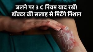 दीये से जलने पर क्या करें? जलने की चोट पर डॉक्टर की सलाह, याद रखें ये 3 C और निशान नहीं पड़ेगा