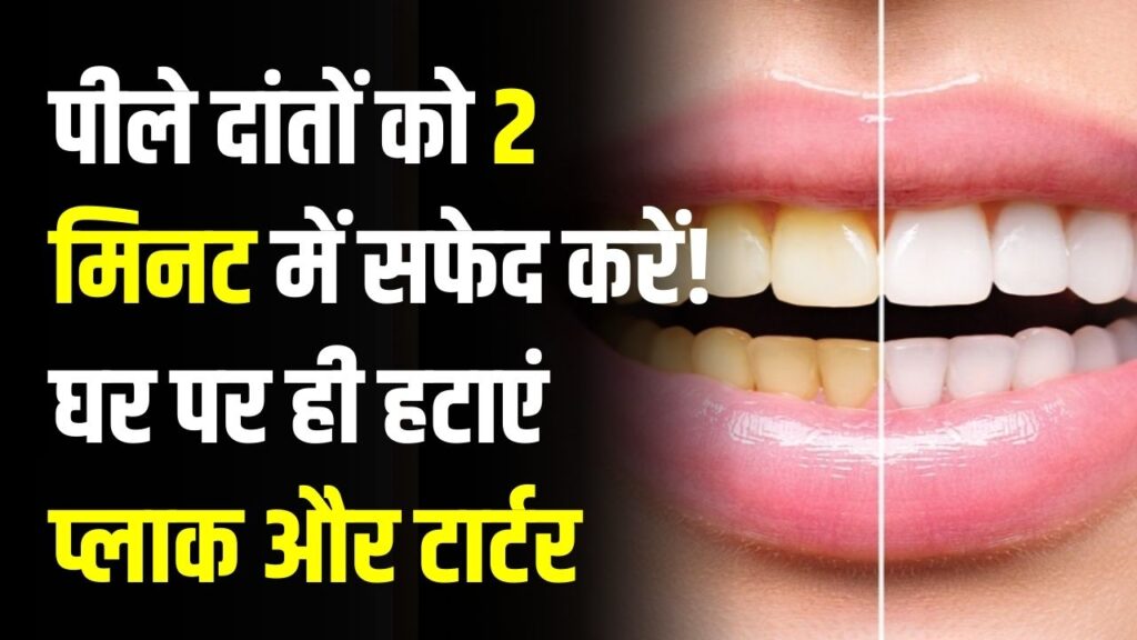 Home Remedy: पीले दांतों को 2 मिनट में सफेद करें! घर पर ही हटाएं प्लाक और टार्टर