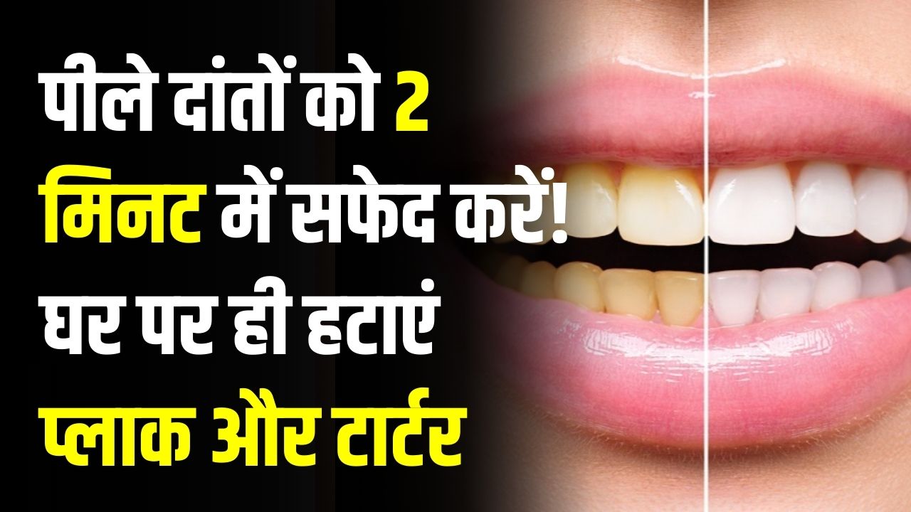Home Remedy: पीले दांतों को 2 मिनट में सफेद करें! घर पर ही हटाएं प्लाक और टार्टर