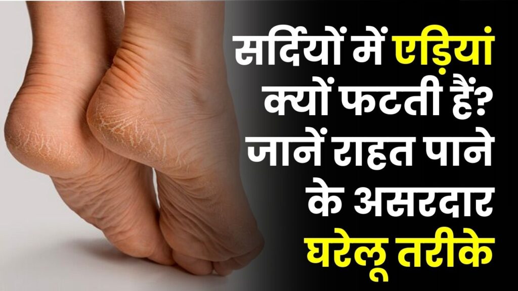 सर्दियों में एड़ियां क्यों फटती हैं? कारण चौंकाने वाले, इन घरेलू तरीकों से मिनटों में मिलेगी राहत Winter Cracked Heels