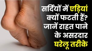 सर्दियों में एड़ियां क्यों फटती हैं? कारण चौंकाने वाले, इन घरेलू तरीकों से मिनटों में मिलेगी राहत Winter Cracked Heels
