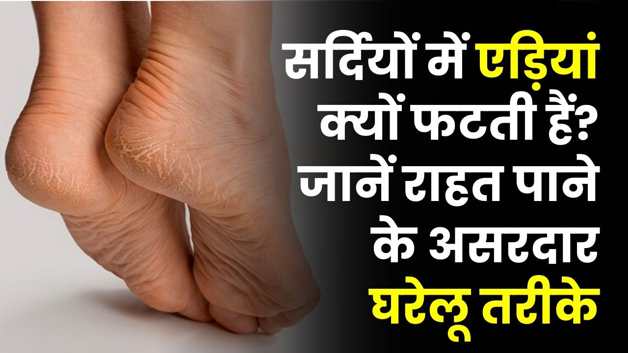 सर्दियों में एड़ियां क्यों फटती हैं? कारण चौंकाने वाले, इन घरेलू तरीकों से मिनटों में मिलेगी राहत Winter Cracked Heels