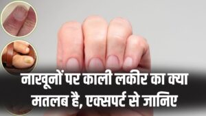 सावधान! नाखूनों पर काली लकीर दिखना सामान्य नहीं, एक्सपर्ट्स ने बताया ये किस गंभीर बीमारी का है संकेत।