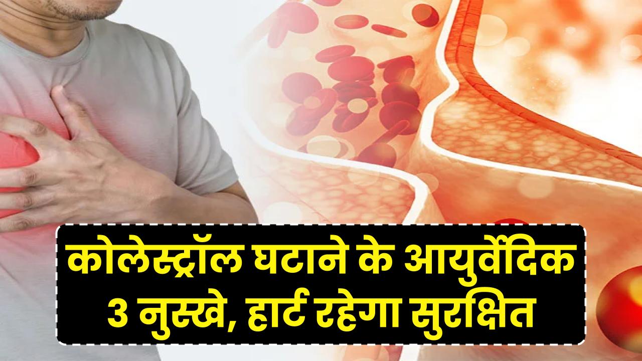 कोलेस्ट्रॉल को जड़ से खत्म करेंगे आयुर्वेद के ये 3 नुस्खे; हार्ट अटैक का खतरा होगा कम, आज ही आजमाएं ये उपाय