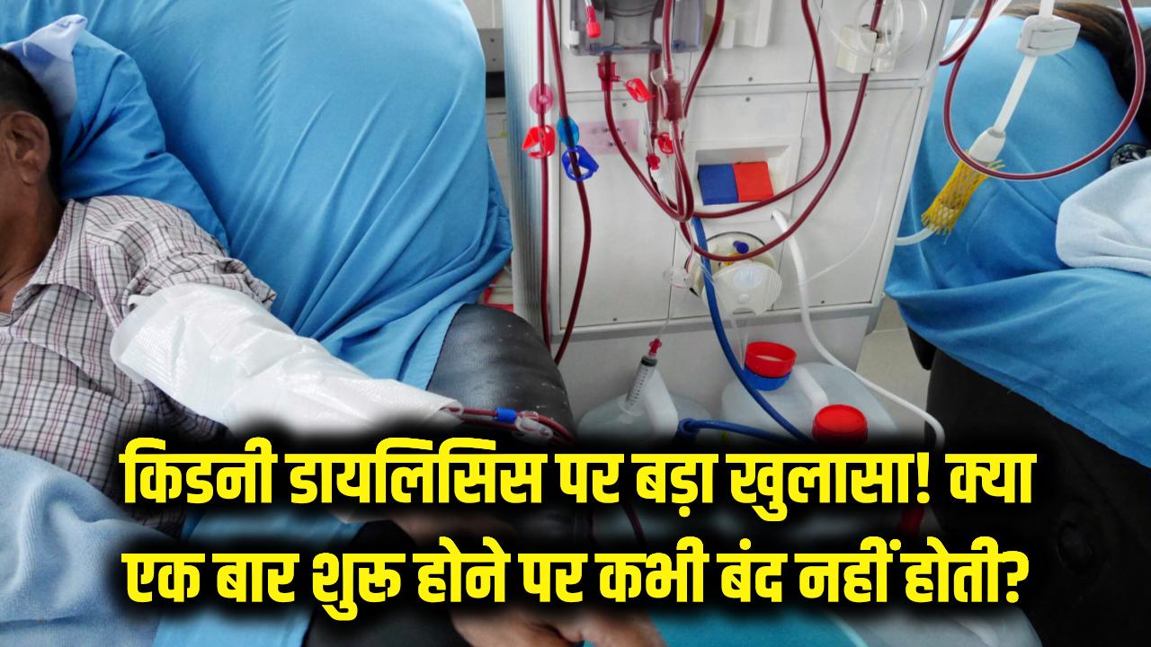 किडनी डायलिसिस को लेकर डर खत्म! क्या एक बार शुरू होने पर यह कभी बंद नहीं होती? डॉक्टर का खुलासा
