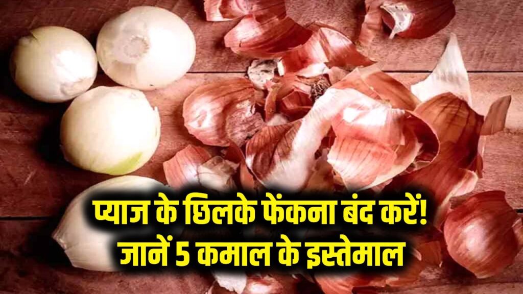 प्याज के छिलके फेंकने की गलती न करें! इसके 5 जादुई इस्तेमाल जानकर दंग रह जाएंगे आप 1 प्याज के छिलके फेंकने की गलती न करें! इसके 5 जादुई इस्तेमाल जानकर दंग रह जाएंगे आप