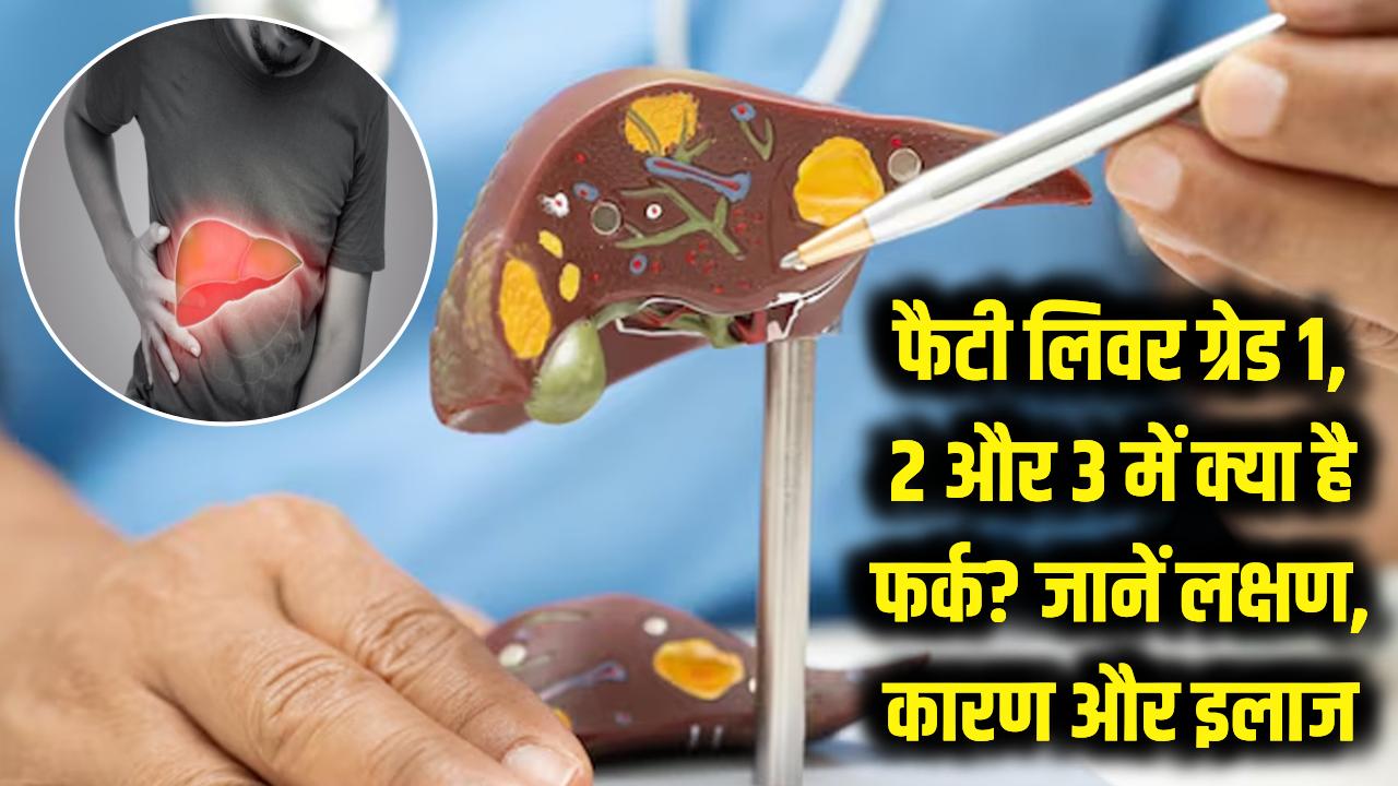 फैटी लिवर ग्रेड 1, 2 और 3 में क्या है फर्क? जानें लक्षण, कारण और इलाज; लापरवाही पड़ सकती है भारी